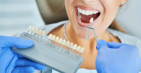 Teeth Whitening – Effective Methods for a Bright Smile